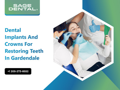 Dental Implants and Crowns for Restoring Teeth in Gardendale.jpg