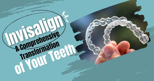 Invisalign A Comprehensive Transformation of Your Teeth.jpg