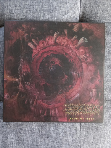 Hyperdontia (1).jpg