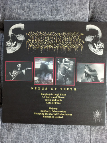 Hyperdontia (2).jpg