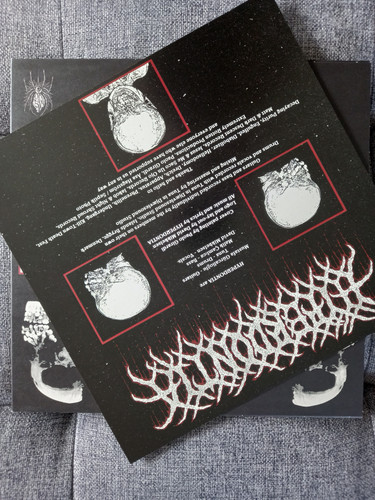 Hyperdontia (3).jpg