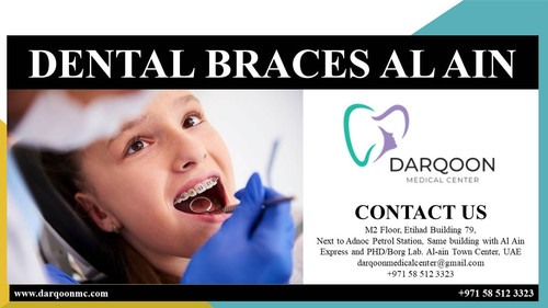 DENTAL BRACES AL AIN.jpg