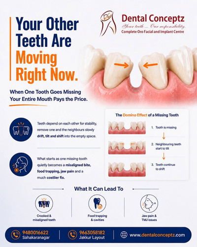 Your Other Teeth Are Moving Right Now.jpg