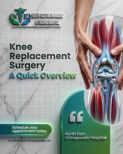 Knee Replacement Surgery: A Quick Overview.jpg