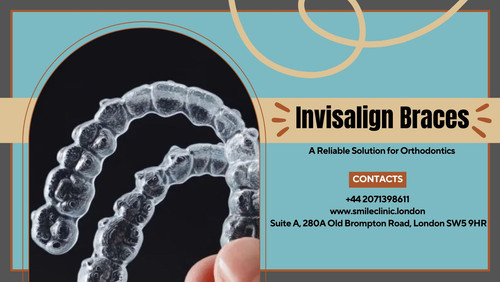 Invisalign Braces A Reliable Solution for Orthodontics.jpg