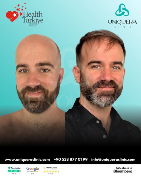 World Class Luxury Hair Transplant in Turkey – Uniquera Clinic.jpg