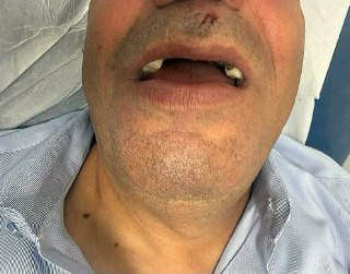 صورة الخبر