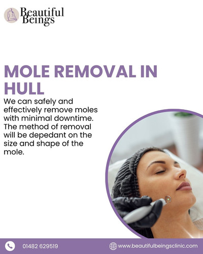 mole removal in hull.jpg
