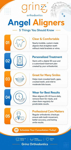 Angel Aligners 5 Things You Should Know Before Starting Treatment.jpg