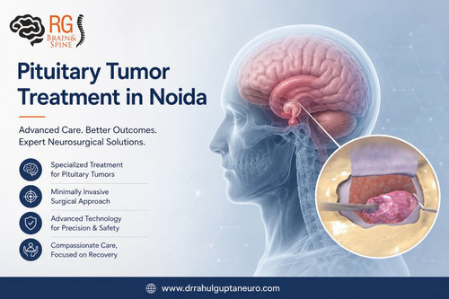 Understanding Pituitary Tumor Treatment in Noida.jpg