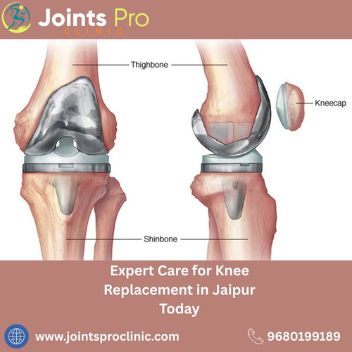 Expert Care for Knee Replacement in Jaipur Today.jpg