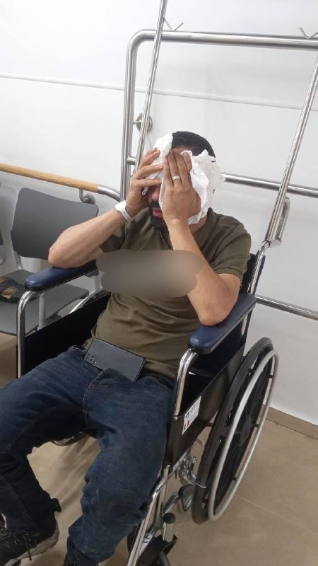 صورة| إصابة شاب (45 عامًا) بحروق في وجهه جراء هجوم مستوطن عليه ورشه بالغاز أثناء مروره من بلدة شعفاط شمال القدس المحتلة....