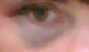 2026 01 15 black eye.png