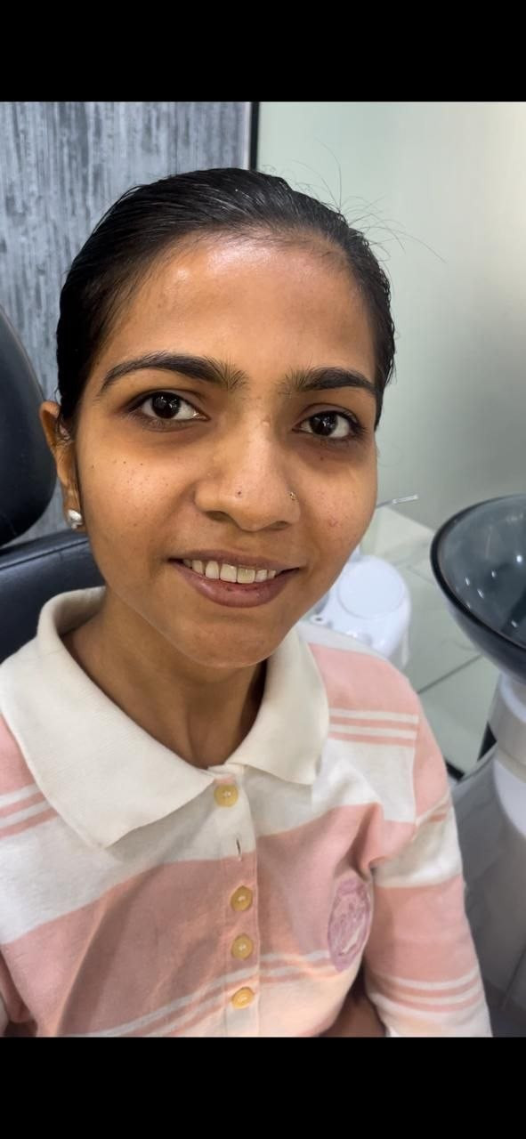 Before missing tooth