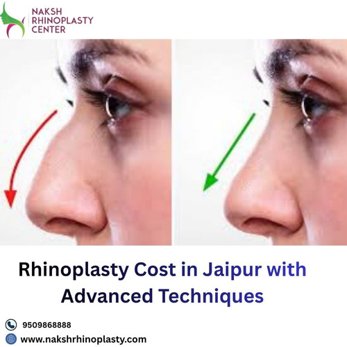 Rhinoplasty Cost in Jaipur with Advanced Techniques.jpg