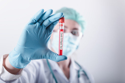 vecteezy coronavirus lab rapid sample test concept 1236045.jpg