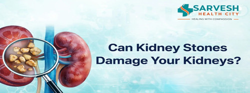 can kidney stones damage your kidneys.jpg