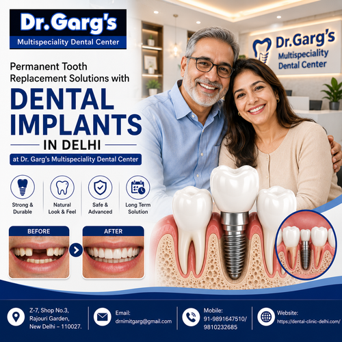 Permanent Tooth Replacement Solutions with Dental Implants in Delhi at Dr. Garg’s Dental Center.png
