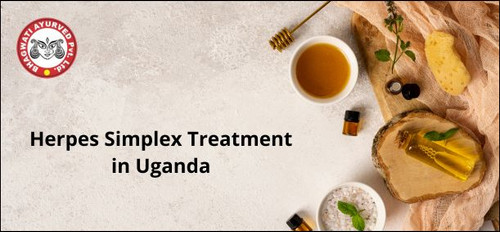 Herpes Simplex Treatment in Uganda - Bhagwati Ayurved.jpg
