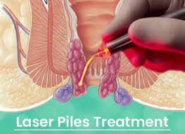Dr Garje Piles Fistula Center in Kalyan provides state-of-the-art laser treatment for piles, fissure.jpg