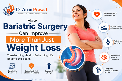 How Bariatric Surgery Can Improve More Than Just Weight Loss | Dr Arun Prasad.png