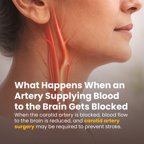 What Happens When an Artery Supplying Blood to the Brain Gets Blocked.jpg