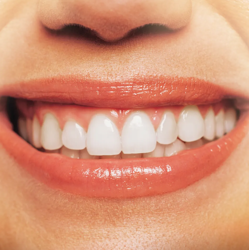 How to Cure Gum Disease Treatment Queens.png