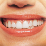 How to Cure Gum Disease Treatment Queens