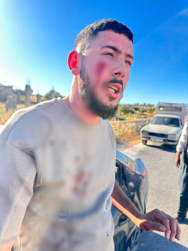 إصابة الشاب محمد سليم البدن؛ جراء اعتداء المستوطنين عليه على الطريق بين قريتي الرشايدة وكيسان، جنوب شرق بيت لحم....
