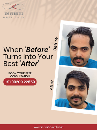 infinitihairclub 1769596218 3819972328500115421 4864994424.jpg