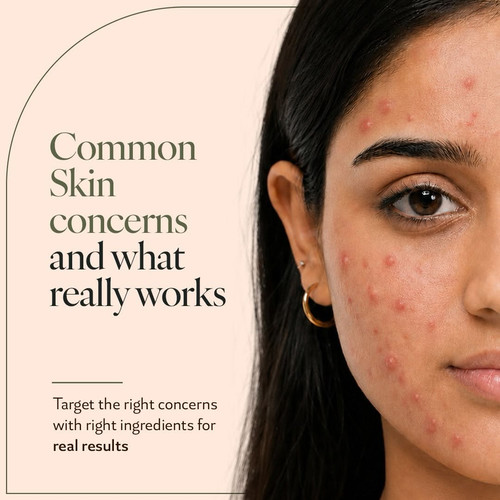 Natural Acne Inflammation Relief for Clearer Healthier Skin – Amiy Naturals.jpg