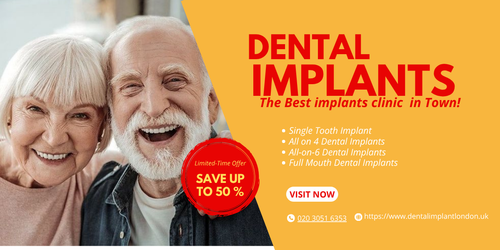 Grabs deals and offers on dental implants.png