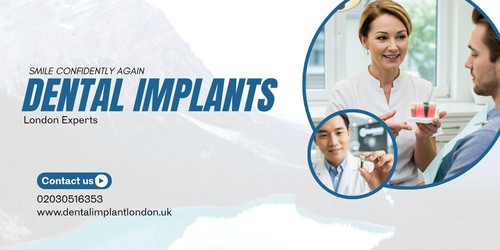 Smile Confidently Again – Dental Implants London Experts.jpg