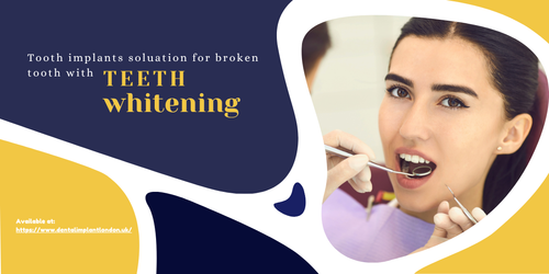 Tooth implants soluation for broken tooth with teeth whitening.png