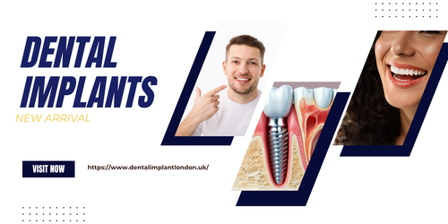 Dental Implants.png