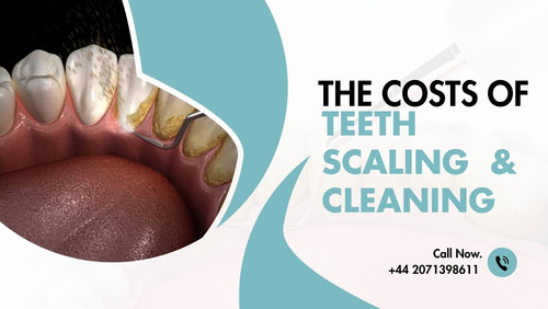 Understanding The Costs of Teeth Scaling & Cleaning.jpg