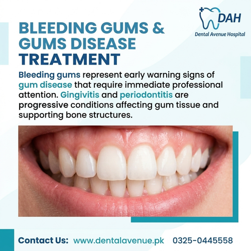 bleeding gums and gums disease treatment.png