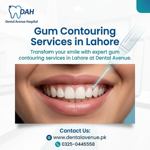 gum contouring services in lahore.png