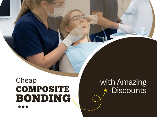 Cheap Composite Bonding London with Amazing Discounts.jpg