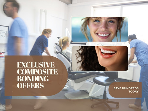 Exclusive Composite Bonding Offers – Save Hundreds Today.jpg