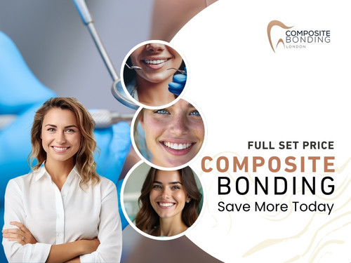 Composite Bonding Full Set Price – Save More Today.jpg