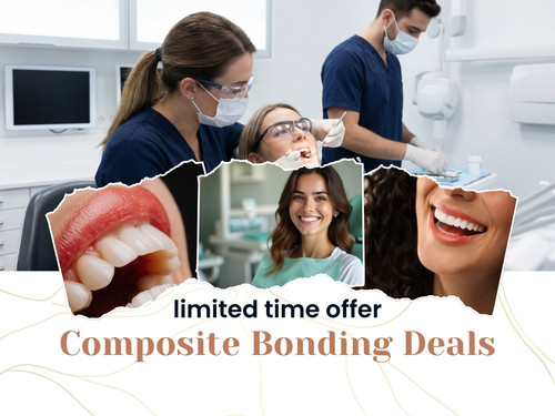 Best Composite Bonding Deals London – Limited Time Offer.jpg