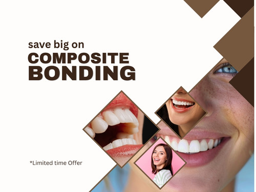 Save Big on Composite Bonding London – Limited Offer.jpg