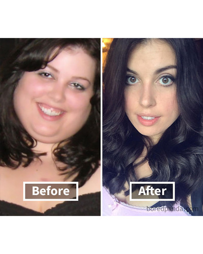 before after weight loss face transformation 2292 5a2a3f09b1b07 700 bordered.jpg