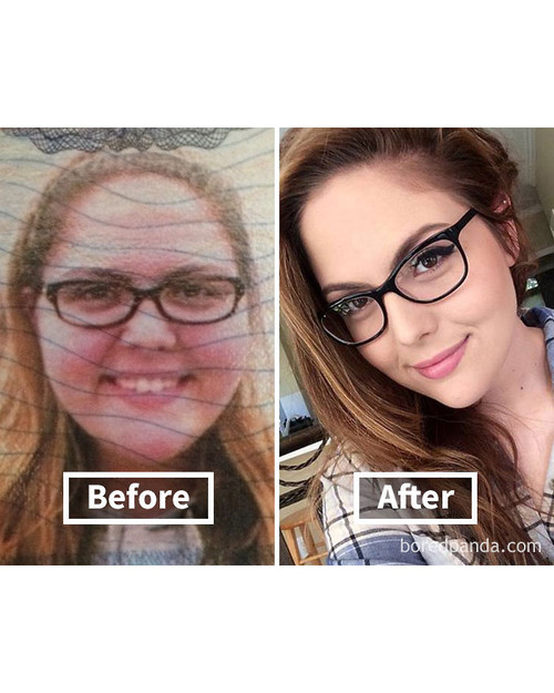 before after weight loss face transformation 129 5a27b3b256d14 700 bordered.jpg
