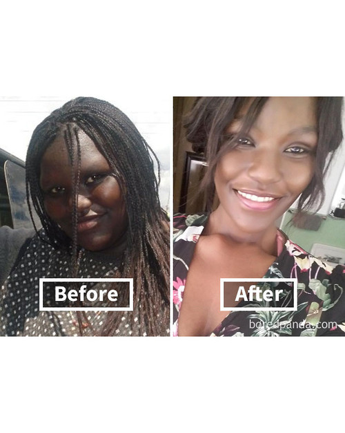 before after weight loss face transformation 202 5a2e7858092f7 700 bordered.jpg