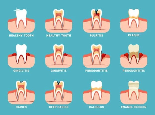Dental Implants Hicksville.jpg