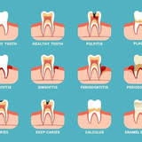 Dental Implants Hicksville