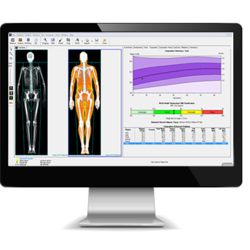 Body composition testing San Diego.jpg