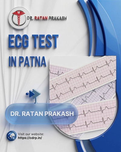 Best ECG Test in Patna: Dr. Ratan Prakash.jpg